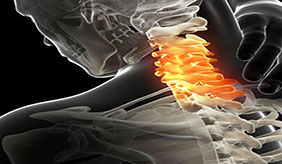 你的颈椎状况怕是连养生迪都蹦不了哦！