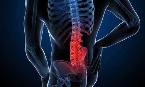 强直性脊柱炎与睡眠