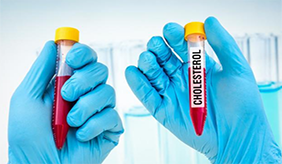 甘油三酯总胆固醇都偏高怎么降？