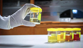 每次体检都做尿检，到底有什么意义？