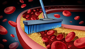 饭后做什么，有助清理血管？