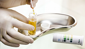 尿常规能查出哪些病？