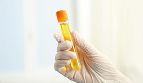 尿液出现泡沫，就说明肾脏受损出现蛋白尿？