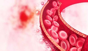 提醒：5种伤血管的食物，甜食排第四，排在首位大多数人经常忽略