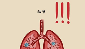 患有“肺结节”，平时要少碰4种“物质”