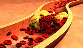 血管堵不堵，看腿就知道，腿部出现3个情况，说明血管有问题了