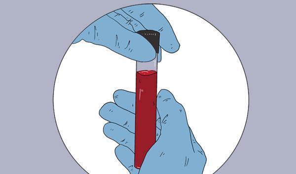 做血脂检查，其他指标合格，只有甘油三酯升高，说明什么？