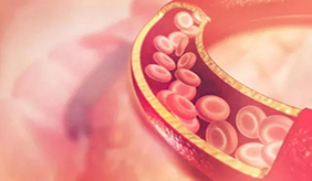 最新血脂管理指南：4类高危人群要小心！