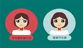 甲亢和甲减到底怎么区分